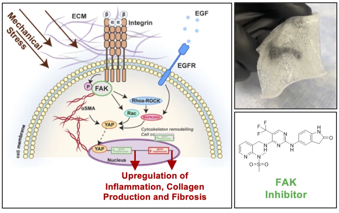 Targeting FAK signalling diagram